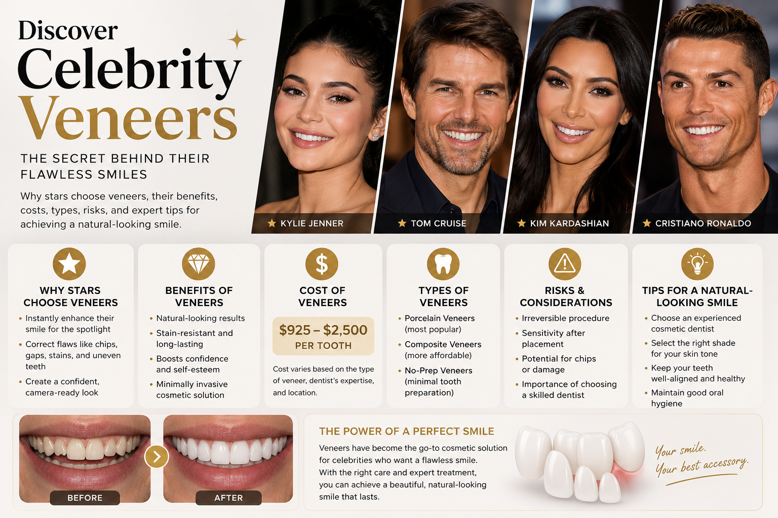 celebrity veneers
